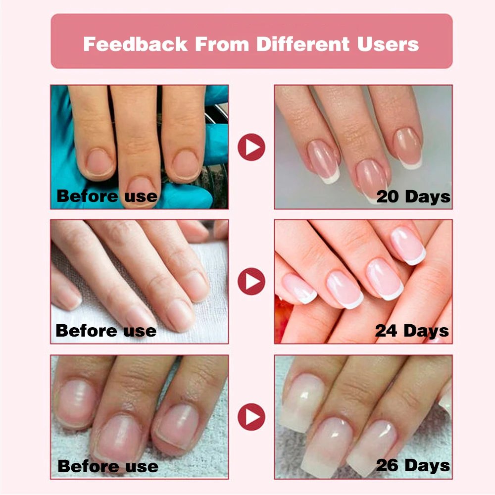 KODIES GEL Nail Strengthener Growth Restore Hardener Clear Nail Polish Base Coat Fast Dry 15ML Strong Repair Nail Art Treatment KODIES GEL Nail Strengthener Growth Restore Hardener Clear Nail Polish Base Coat Fast Dry 15ML Strong Repair Nail Art Treatment