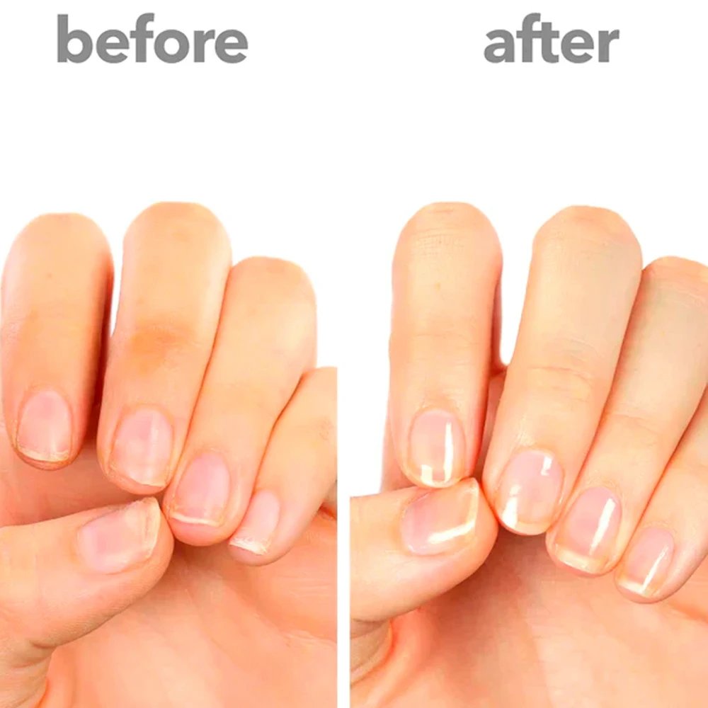 KODIES GEL Nail Strengthener Growth Restore Hardener Clear Nail Polish Base Coat Fast Dry 15ML Strong Repair Nail Art Treatment KODIES GEL Nail Strengthener Growth Restore Hardener Clear Nail Polish Base Coat Fast Dry 15ML Strong Repair Nail Art Treatment