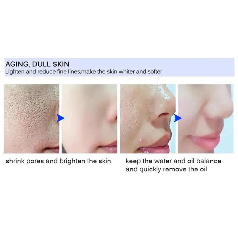 Salicylic Acid Pore Shrinking Cream Quick Remove Blackehead Elimination Large Pores Tighten Face Smooth Skin Care Products New Salicylic Acid Pore Shrinking Cream Quick Remove Blackehead Elimination Large Pores Tighten Face Smooth Skin Care Products New