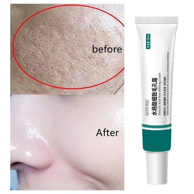 Salicylic Acid Pore Shrinking Cream Quick Remove Blackehead Elimination Large Pores Tighten Face Smooth Skin Care Products New Salicylic Acid Pore Shrinking Cream Quick Remove Blackehead Elimination Large Pores Tighten Face Smooth Skin Care Products New