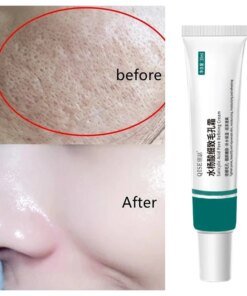 Alternative view of Salicylic Acid Pore Shrinking Cream Quick Remove Blackehead Elimination Large Pores Tighten Face Smooth Skin Care Products New